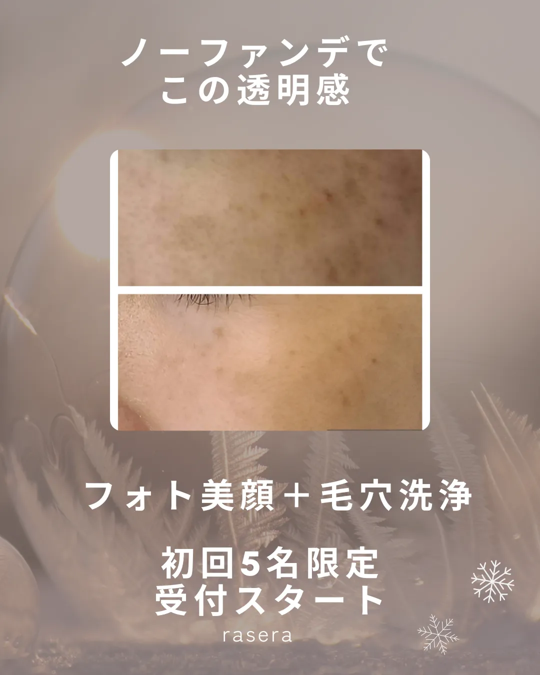 限定5名【毛穴洗浄・フォト美顔・小田原】